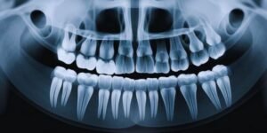 Child's Dental X-ray: Evaluate Space Issues