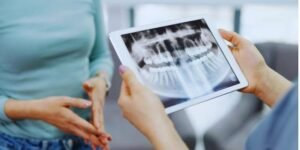 Importance of Child's Dental X-ray